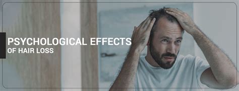 The Emotional Impact of Hair Loss: How a Hair Transplant Can Change Your Life